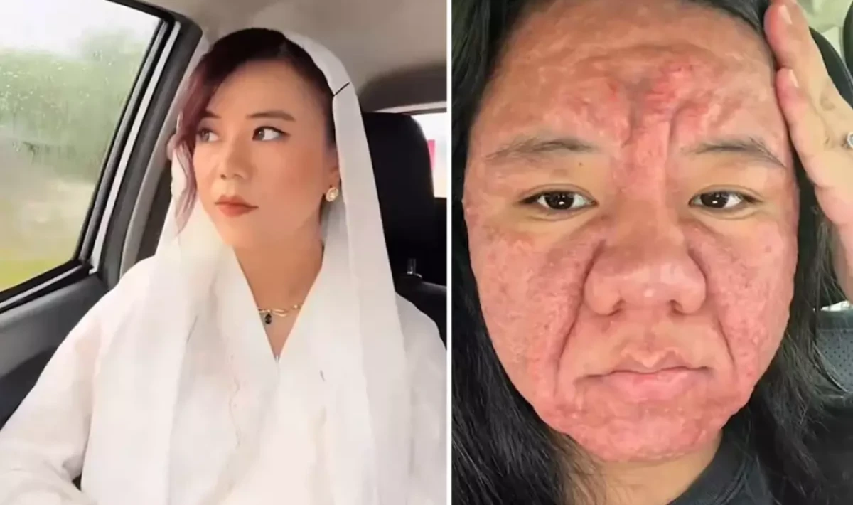 Yok Böyle Bir Değişim! Genç Kadın Bir Anda Yıllarca Yaşlandı, Sosyal Medya Yıkıldı